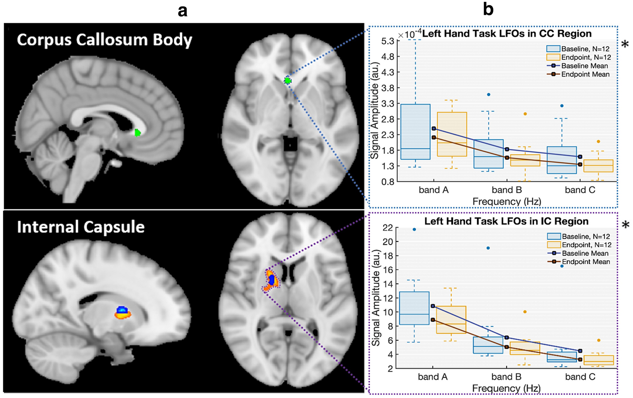 Published MRI figure showing the internal capsule and corpus callosum regions of interest, with before-and-after low-frequency oscillation measurements